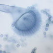 Aspergillus fumigatus, grossissement x 400