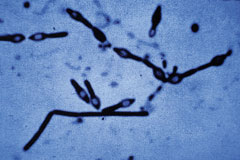 Clostridium sporulé, grossissement x 1000