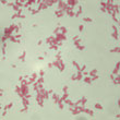 Escherichia coli (coloration de Gram, grossissement x 1000) - © Photo AgroParisTech Escherichia coli (coloration de Gram, grossissement x 1000)