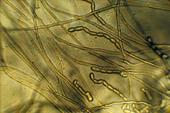 Geotrichum; grossissement x 400