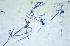 Lactobacillus, grossissement x 1000