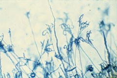Penicillium, grossissement x 400